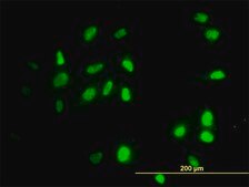 Monoclonal Anti-RAD18 antibody produced in mouse clone 3H7, purified immunoglobulin, buffered aqueous solution