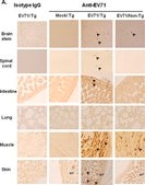 抗エンテロウイルス71抗体、コクサッキーA16と交差反応、クローン422-8D-4C-4D ascites fluid, clone 422-8D-4C-4D, Chemicon®