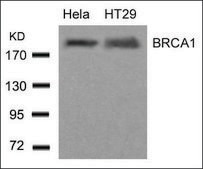 Anti-BRCA1 (Ab-1423) antibody produced in rabbit affinity isolated antibody