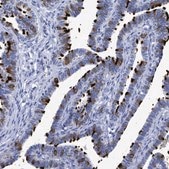 Anti-RSPH1 antibody produced in rabbit Prestige Antibodies® Powered by Atlas Antibodies, affinity isolated antibody, buffered aqueous glycerol solution