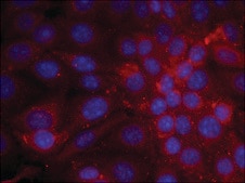Anti-EGFR (Ab-1070) antibody produced in rabbit affinity isolated antibody