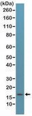 Anti-p16ink4a (CDKN2A) antibody, Rabbit monoclonal recombinant, expressed in HEK 293 cells, clone RM267, purified immunoglobulin