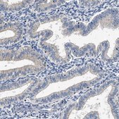 Anti-INHA antibody produced in rabbit Prestige Antibodies® Powered by Atlas Antibodies, affinity isolated antibody, buffered aqueous glycerol solution