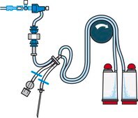 Steritest&#174; NEO Device For medical devices and collapsible bags., Red base canister provided with 3 needle adapters to connect to a variety of test devices., pkg of 10 blisters per box, Single packed