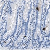 Anti-SST antibody produced in rabbit affinity isolated antibody, buffered aqueous glycerol solution