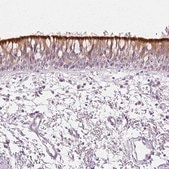 Anti-ROPN1L antibody produced in rabbit affinity isolated antibody, buffered aqueous glycerol solution