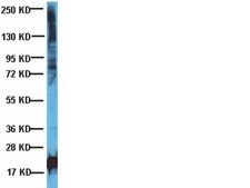 Anti-Phosphothreonine Antibody Chemicon®, from rabbit