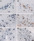 Anti-Tyrosine Hydroxylase Antibody, clone LNC1 ascites fluid, clone LNC1, Chemicon®