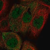 Anti-ADIRF antibody produced in rabbit Prestige Antibodies® Powered by Atlas Antibodies, affinity isolated antibody, buffered aqueous glycerol solution