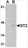 Anti-ST2 antibody produced in rabbit affinity isolated antibody, buffered aqueous solution