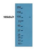 Anti-PKD2 Antibody Upstate®, from rabbit