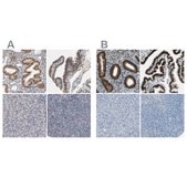 抗PGR ウサギ宿主抗体 Ab1, Prestige Antibodies® Powered by Atlas Antibodies, affinity isolated antibody, buffered aqueous glycerol solution