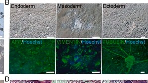 モノクロナール抗ビメンチン マウス宿主抗体 clone V9, ascites fluid