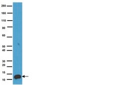 Anti-S-100 Protein Antibody, clone 15E2E2 clone 15E2E2, Chemicon®, from mouse