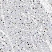 Anti-PTGDS antibody produced in rabbit Prestige Antibodies® Powered by Atlas Antibodies, affinity isolated antibody, buffered aqueous glycerol solution