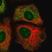 Anti-GRAMD1B antibody produced in rabbit Prestige Antibodies® Powered by Atlas Antibodies, affinity isolated antibody, buffered aqueous glycerol solution
