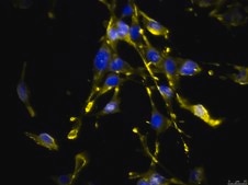 OSUMMER.9 Mouse NRAS-Mutant Melanoma Cell Line
