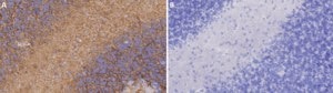 Anti-Aquaporin 4 Antibody Chemicon®, from rabbit