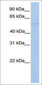 Anti-RUVBL1 antibody produced in rabbit affinity isolated antibody