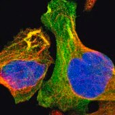 Anti-TMOD3 antibody produced in rabbit Prestige Antibodies® Powered by Atlas Antibodies, affinity isolated antibody, buffered aqueous glycerol solution