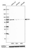 抗ESR1 ウサギ宿主抗体 Prestige Antibodies® Powered by Atlas Antibodies, affinity isolated antibody, buffered aqueous glycerol solution