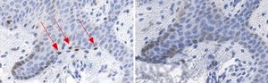 Anti-MITF Antibody, clone 1E2 ZooMAb® Rabbit Monoclonal recombinant, expressed in HEK 293 cells