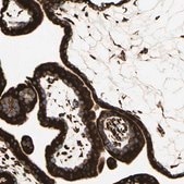 Anti-RRBP1 antibody produced in rabbit Prestige Antibodies® Powered by Atlas Antibodies, affinity isolated antibody, buffered aqueous glycerol solution