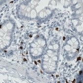 Monoclonal Anti-MMP9 antibody produced in mouse Prestige Antibodies® Powered by Atlas Antibodies, clone CL0538, purified immunoglobulin, buffered aqueous glycerol solution