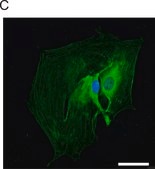 Anti-Glial Fibrillary Acidic Protein antibody produced in rabbit IgG fraction of antiserum, buffered aqueous solution