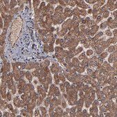 Anti-BNIP3 antibody produced in rabbit Prestige Antibodies® Powered by Atlas Antibodies, affinity isolated antibody, buffered aqueous glycerol solution