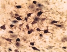 Anti-Choline Acetyltransferase Antibody serum, Chemicon®