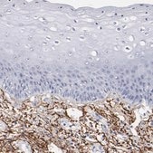 Anti-EMILIN1 antibody produced in rabbit Prestige Antibodies® Powered by Atlas Antibodies, affinity isolated antibody, buffered aqueous glycerol solution
