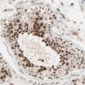 Anti-DAZAP1 antibody produced in rabbit Ab1, Prestige Antibodies® Powered by Atlas Antibodies, affinity isolated antibody, buffered aqueous glycerol solution