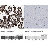 Anti-RRBP1 antibody produced in rabbit Prestige Antibodies® Powered by Atlas Antibodies, affinity isolated antibody, buffered aqueous glycerol solution
