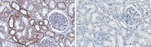 Anti-PI-3 kinase p110α Antibody, clone 1J4 ZooMAb® Rabbit Monoclonal recombinant, expressed in HEK 293 cells