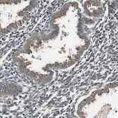 Anti-SEC62 antibody produced in rabbit Prestige Antibodies® Powered by Atlas Antibodies, affinity isolated antibody, buffered aqueous glycerol solution