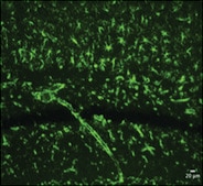 Anti-Nestin antibody produced in rabbit ~1 mg/mL, affinity isolated antibody, buffered aqueous solution