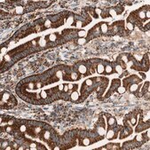 Anti-TOMM20 antibody produced in rabbit Prestige Antibodies® Powered by Atlas Antibodies, affinity isolated antibody, buffered aqueous glycerol solution