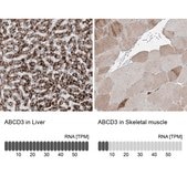 抗ABCD3抗体 ウサギ宿主抗体 Prestige Antibodies® Powered by Atlas Antibodies, affinity isolated antibody, buffered aqueous glycerol solution