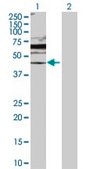 Anti-DUSP6 antibody produced in rabbit purified immunoglobulin, buffered aqueous solution