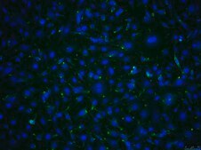 OSUMMER.10 Mouse NRAS-Mutant Melanoma Cell Line
