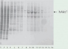cOmplete™, Mini, EDTA-free Protease Inhibitor Cocktail Tablets provided in EASYpacks