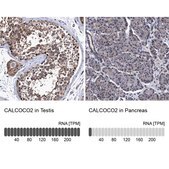 Anti-CALCOCO2 antibody produced in rabbit Prestige Antibodies® Powered by Atlas Antibodies, affinity isolated antibody, buffered aqueous glycerol solution, Ab3