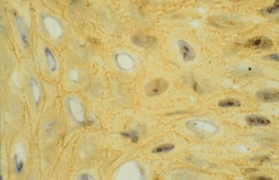Anti-Integrin αV Antibody, clone 13C2 clone 13C2, Chemicon®, from mouse