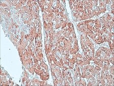 Anti-Superoxide Dismutase (MnSOD) (DD-17) antibody produced in rabbit affinity isolated antibody, buffered aqueous solution