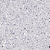 Anti-ADAM2 antibody produced in rabbit Prestige Antibodies® Powered by Atlas Antibodies, affinity isolated antibody, buffered aqueous glycerol solution, Ab1