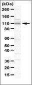 Anti-SMARCAL1 Antibody serum, from rabbit