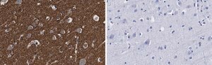Anti-α-synuclein Antibody, clone 1D22 ZooMAb® Rabbit Monoclonal recombinant, expressed in HEK 293 cells