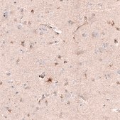 Monoclonal Anti-CHI3L1 antibody produced in mouse Prestige Antibodies® Powered by Atlas Antibodies, clone CL12241, purified immunoglobulin, buffered aqueous glycerol solution