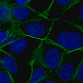 Anti-VANGL1 antibody produced in rabbit Prestige Antibodies® Powered by Atlas Antibodies, affinity isolated antibody, buffered aqueous glycerol solution